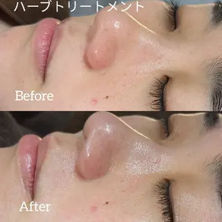 ﾌｪｲｼｬﾙｴｽﾃ ﾗﾄｩｰﾙ伊深のエステ・リラクイメージ