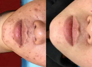 LUMINA ESTHのエステ・リラクイメージ