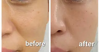 ハーブ温熱ケアサロン【BISKI】所属・ハーブ温熱ケアサロン 【BISKI 】のその他イメージ