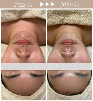 肌のお悩み改善サロン MELIA/朋美のエステ・リラクイメージ