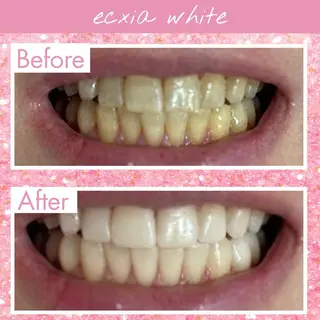 セルフホワイトニング エクシア戸田公園店のその他イメージ