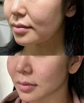 マツエク・マツパ aliaハーブ水光店 エステティシャン募集のエステ・リラクイメージ