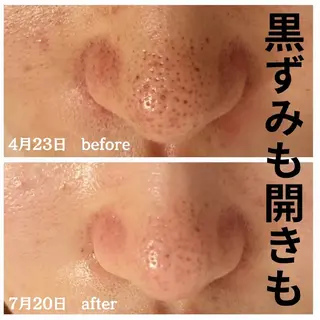 フェイシャル専門サロ ン　ERINのエステ・リラクイメージ