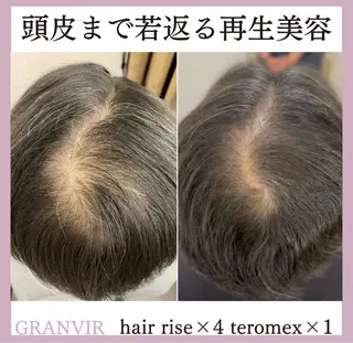 【福岡市西区 エステ】 GRANVIR(グランヴィール)所属・GRANVIR グランヴィールのエステ・リラクイメージ