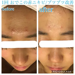 ショート カラー パーマ ヘアアレンジ キッズ ネイル マツエク・マツパ EnsorClair 代表 野口真央のエステ・リラクイメージ