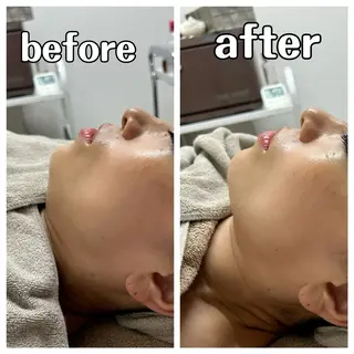 コアラル恵比寿店 chiakiのエステ・リラクイメージ