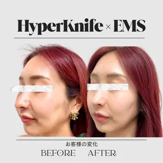 aimer 服部のその他イメージ