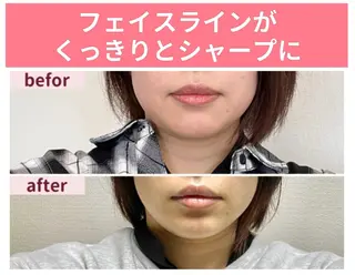 リフトアップ小顔 プランドール所属・痛くない小顔矯正 いまいあやののその他イメージ