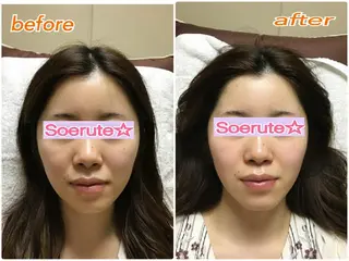 Soerute☆ ソエルテ 井上みえのエステ・リラクイメージ