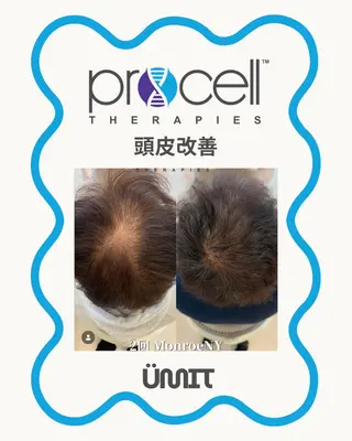 メンズ Ümit(ユミト) プロセルセラピーズのネイルデザイン