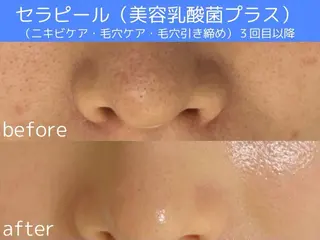 BAUM. 宮村のエステ・リラクイメージ