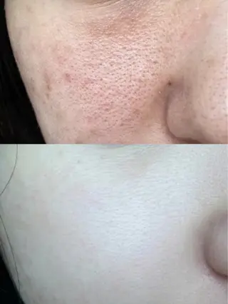 ネイル aliaハーブ水光店 エステティシャン募集のエステ・リラクイメージ