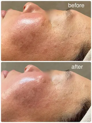 Hisui 小出のエステ・リラクイメージ