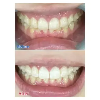 Ｍ渋谷 ホワイトニングのエステ・リラクイメージ