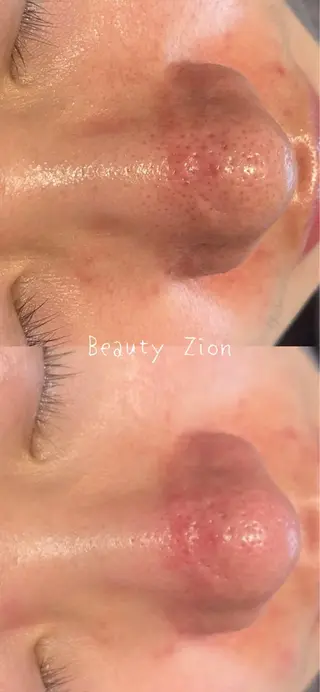 Beauty Zionのエステ・リラクイメージ