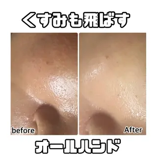 YURUMARU 河ノ瀬店のエステ・リラクイメージ