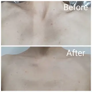 肌質改善Beauty salon Renのエステ・リラクイメージ