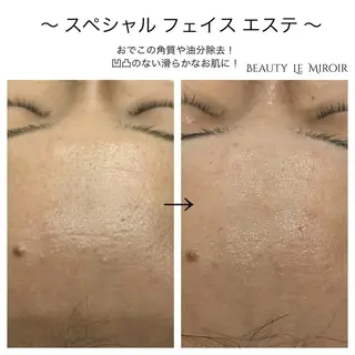 ビューティー ミロワールのエステ・リラクイメージ
