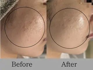 lumirise所属・lumi riseのエステ・リラクイメージ