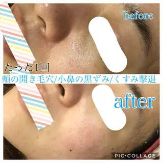 ミディアム カラー パーマ ヘアアレンジ キッズ ネイル マツエク・マツパ EnsorClair 代表 野口真央のエステ・リラクイメージ