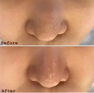 この花 エステサロンのエステ・リラクイメージ