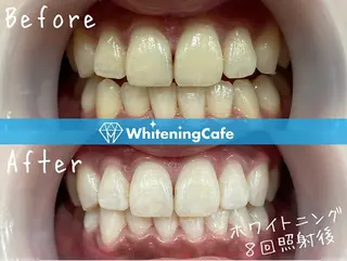 ホワイトニングカフェ 荻窪店のその他イメージ