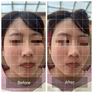 うめきた鍼灸院 SENSEのエステ・リラクイメージ