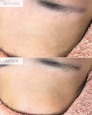 肌質改善専門サロン Bellmi/心斎橋のエステ・リラクイメージ