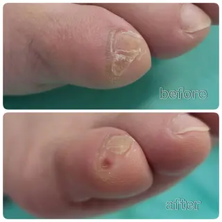 東京巻き爪 アカデミーのエステ・リラクイメージ