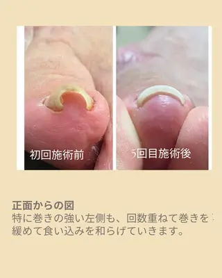 ネイル ダンラップ新里 友簣乃のネイルデザイン