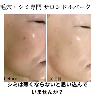 毛穴・シミ専門サロン ルパークのエステ・リラクイメージ