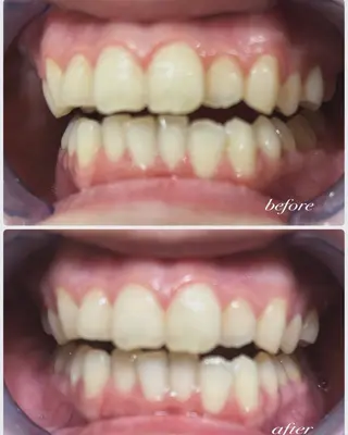 Tieiu ゆりのエステ・リラクイメージ