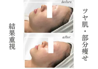 LiAm《美肌管理/ 小顔/脂肪ケア》のその他イメージ