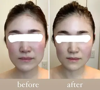 小顔•美肌•まつ毛 サロン　Mimiの眉毛・アイブロウイメージ