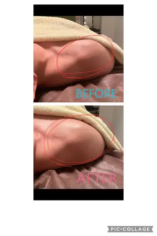 ハウオリベリー所属・うえば すみかのエステ・リラクイメージ