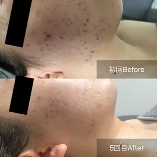 Radiance H.Oのエステ・リラクイメージ