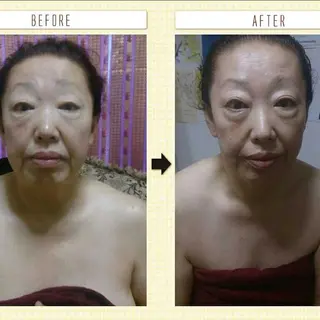 Arebeau 健康的にダイエットのエステ・リラクイメージ