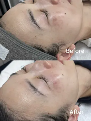 小顔専門看護師クリニカルサロンCOCO所属・小顔と美肌サロン クリニカルサロンココのエステ・リラクイメージ