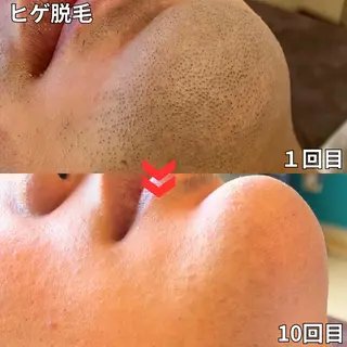 メンズ 都度払い制メンズ脱毛 オーナーのエステ・リラクイメージ