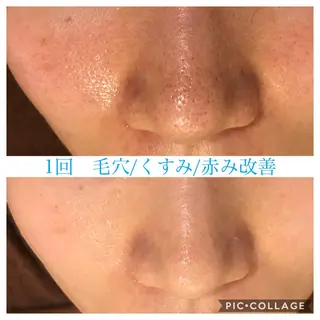 ロング カラー パーマ ヘアアレンジ メンズ キッズ ネイル マツエク・マツパ EnsorClair 代表 野口真央のエステ・リラクイメージ