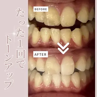 LIBRA自由が丘 ホワイトニングのその他イメージ