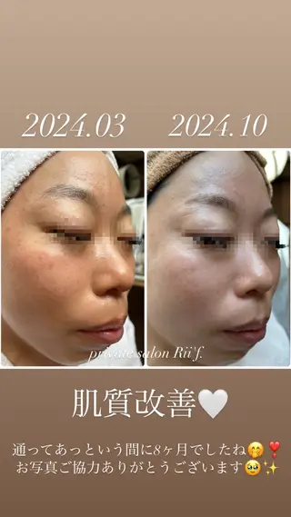 private salon Rii'f.所属・private sa lon Rii'f.のエステ・リラクイメージ