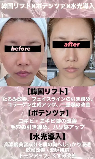 マツエク・マツパ 愛維美水光美肌専門店 メンズレディースokのエステ・リラクイメージ