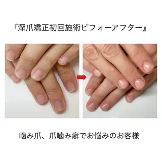 ネイル ネイルサロン アリュームのネイルデザイン