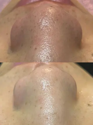 EPIL risaのマツエク・マツパデザイン