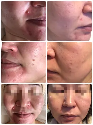 エステティシャン SAORIのエステ・リラクイメージ