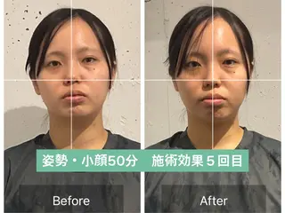 美容整体 小顔矯正 プラスフィール牧野のエステ・リラクイメージ
