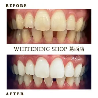 メンズ ホワイトニング ショップ葛西店のその他イメージ