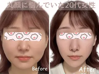 【歴13年】劇的小顔 D rマジックタッチのエステ・リラクイメージ