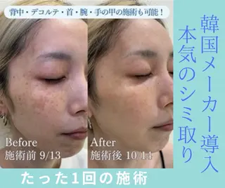 the 別嬪 静岡店のエステ・リラクイメージ